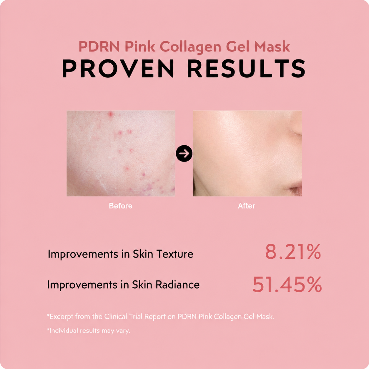 Collagen Mask Duo Set ValléSkin