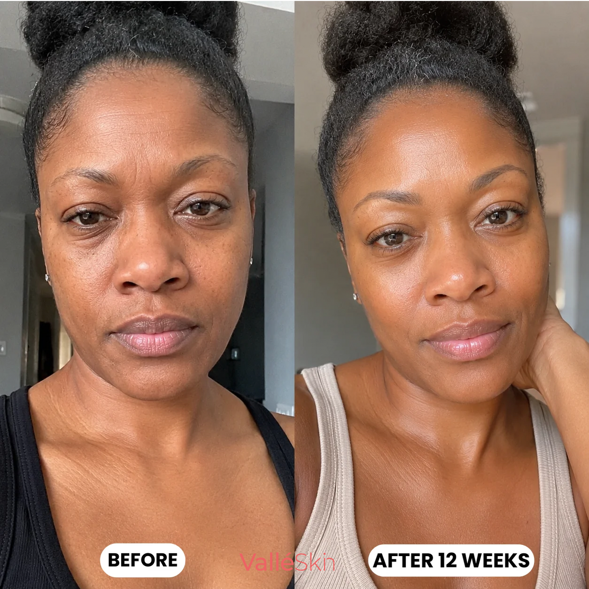 Collagen Glow Up Mask 2.0 ValléSkin