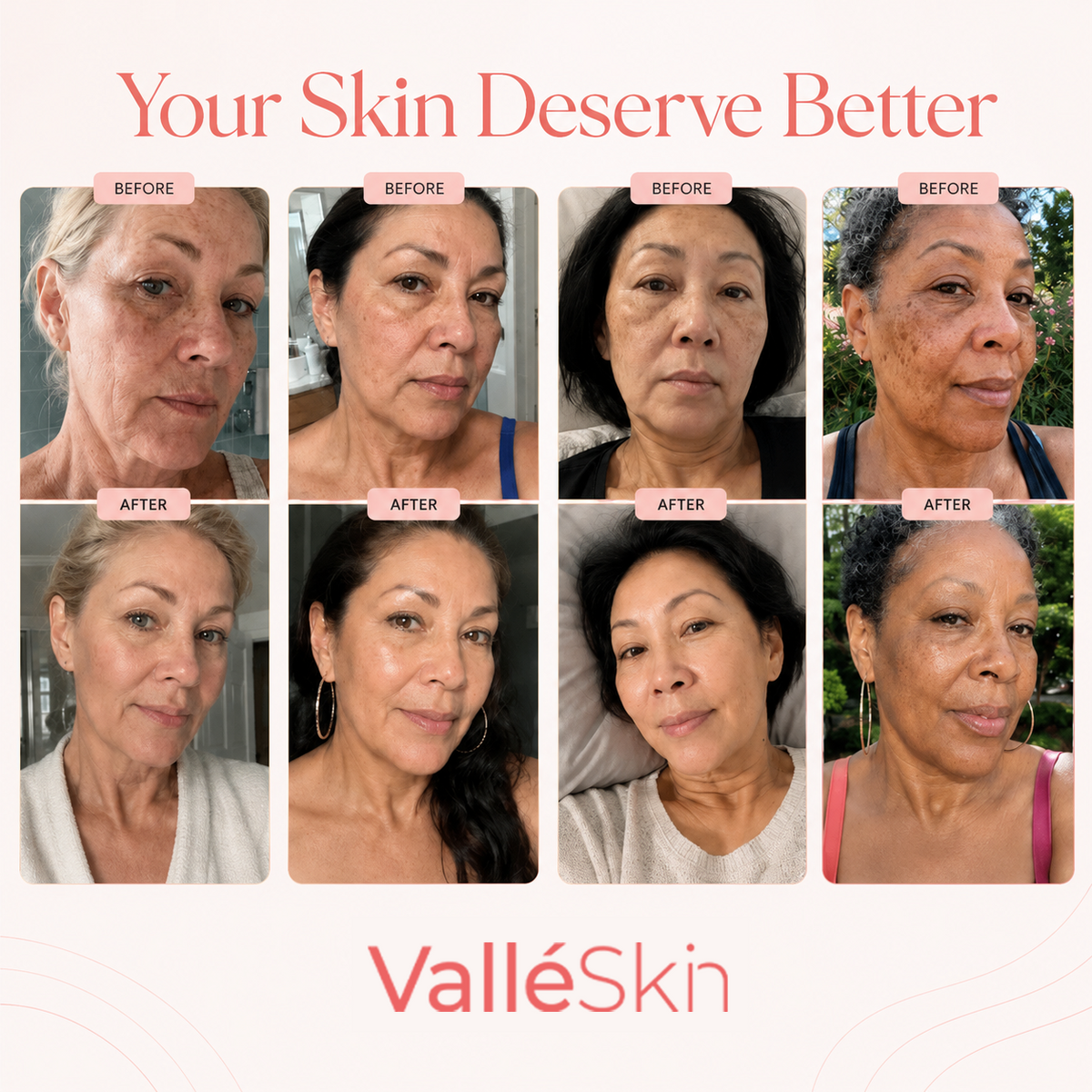 Collagen Glow Up Mask 2.0 ValléSkin