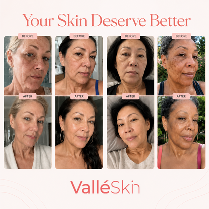 Collagen Glow Up Mask 2.0 ValléSkin