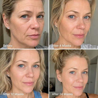 Collagen Glow Up Mask 2.0 ValléSkin