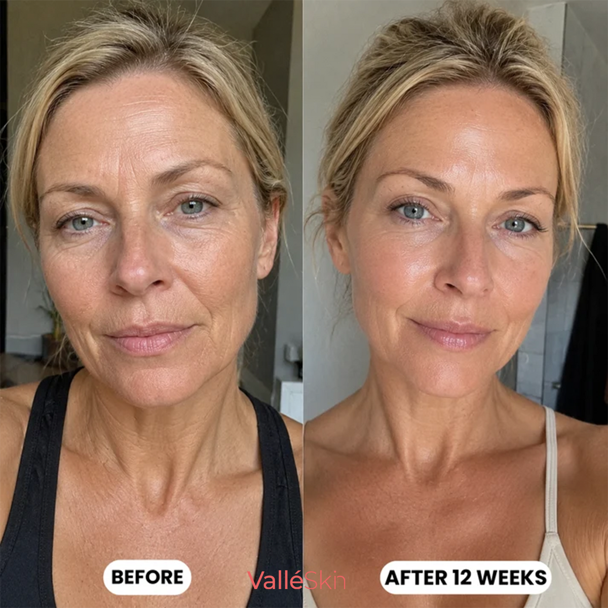 Collagen Glow Up Mask 2.0 ValléSkin