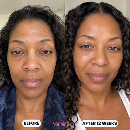 Collagen Glow Up Mask 2.0 ValléSkin