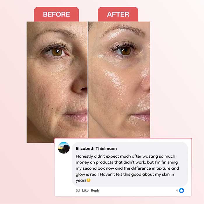 Collagen Mask Bundle ValléSkin