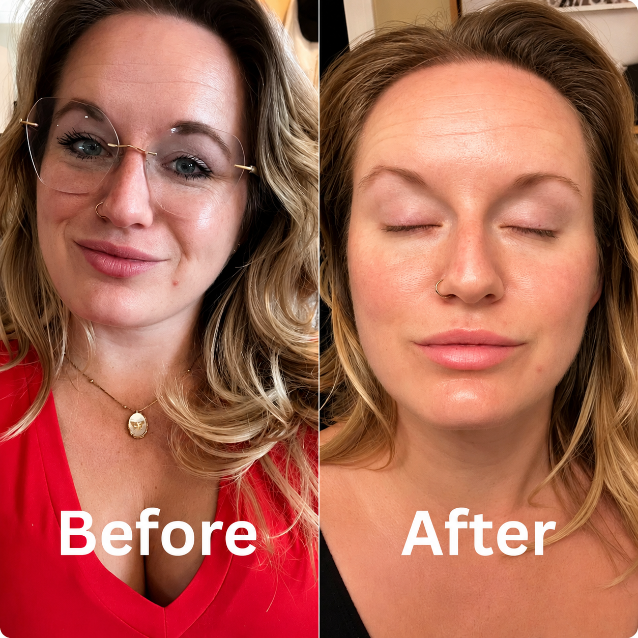 Collagen Glow Up Mask 2.0 ValléSkin