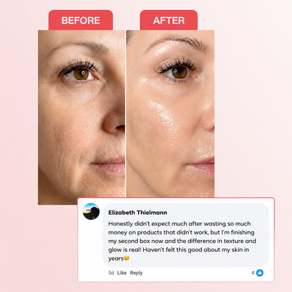 Collagen Mask Bundle ValléSkin