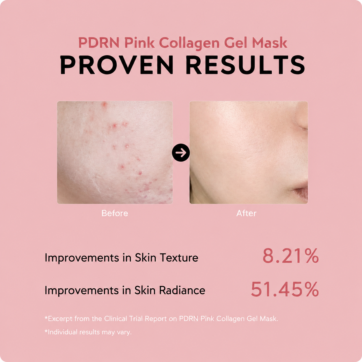 Erase 10 Years & Glow Ritual ValléSkin