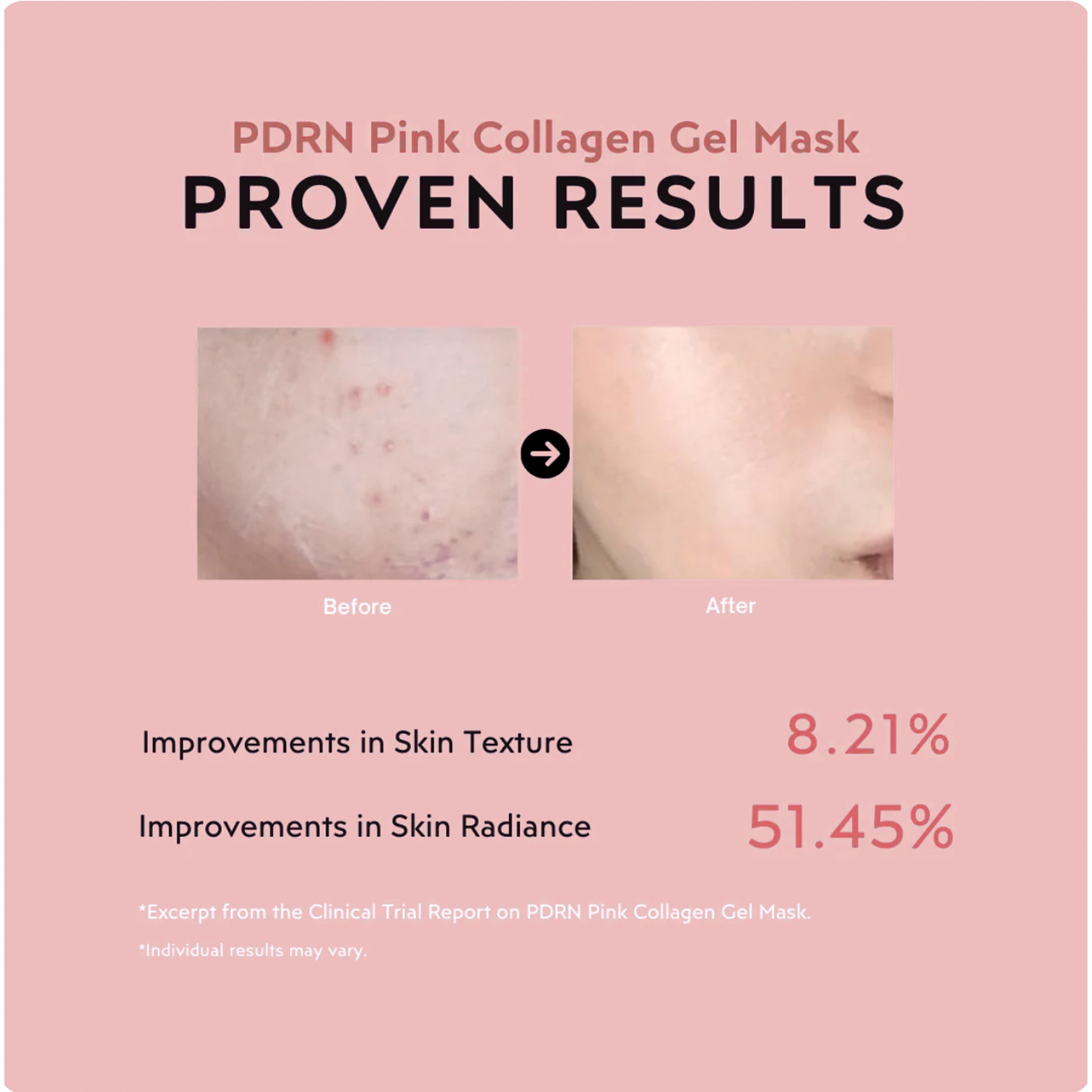 Glass Skin Bundle ValléSkin