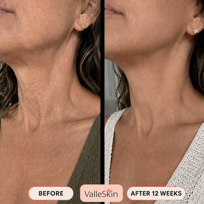 Collagen Neck Mask ValléSkin