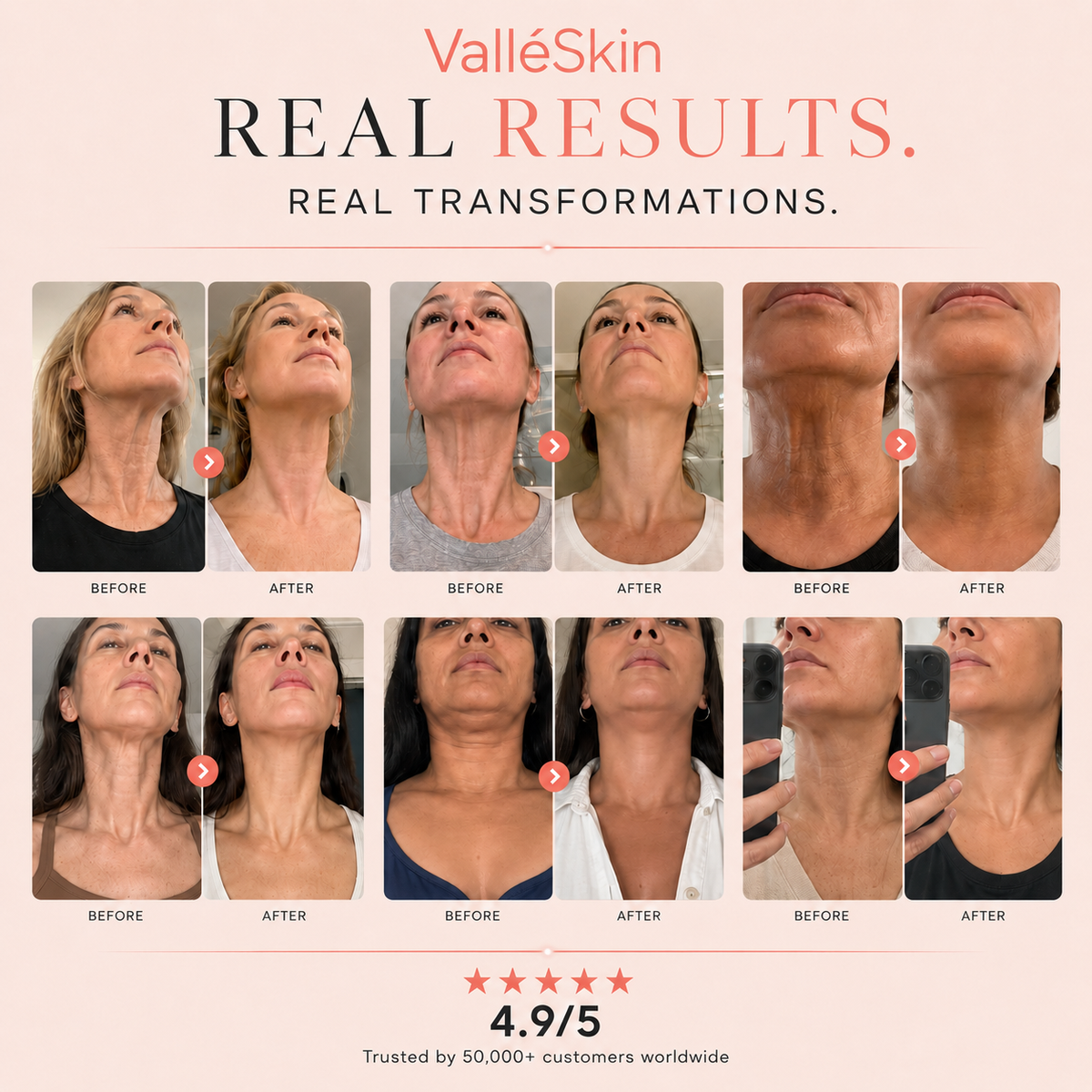 Collagen Neck Mask ValléSkin